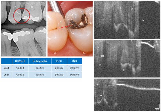 Figure 12