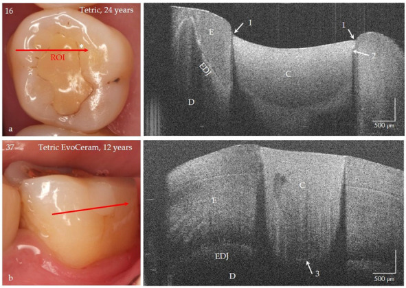 Figure 15