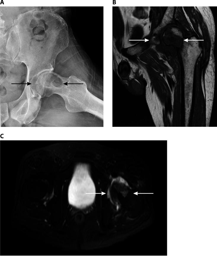 FIG 2