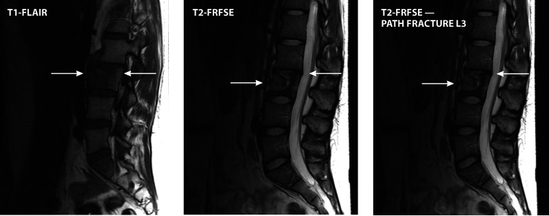 FIG 11