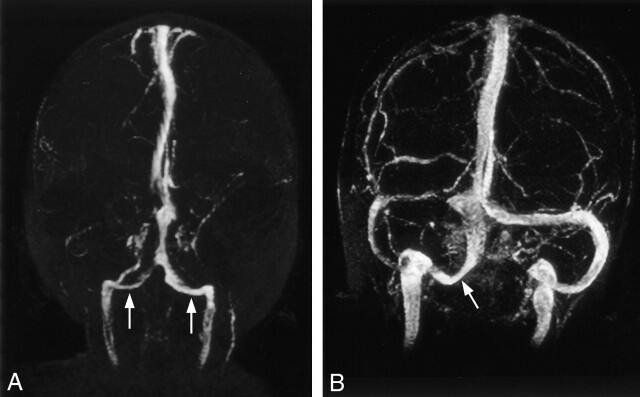 Fig 3.