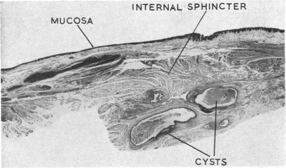 Fig. B