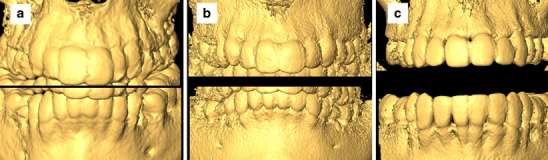 Fig. 3