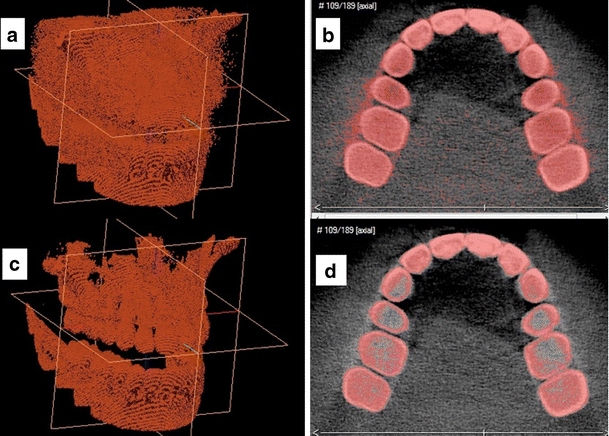 Fig. 1