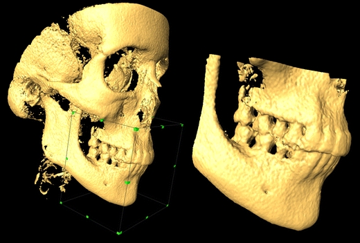 Fig. 2