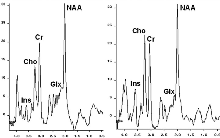 Fig 2.