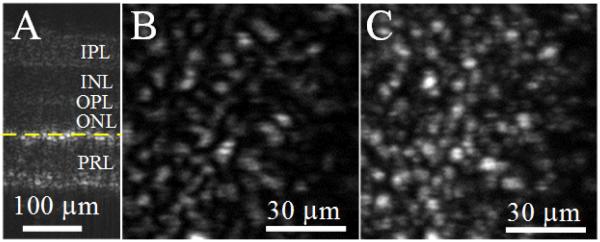 FIG. 12