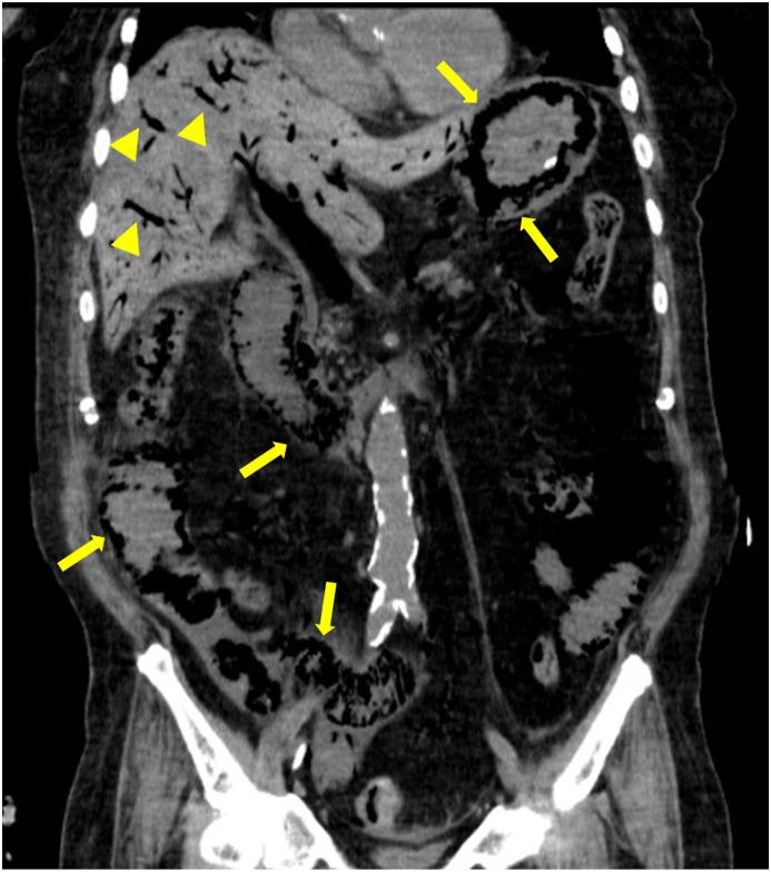 Fig. 1