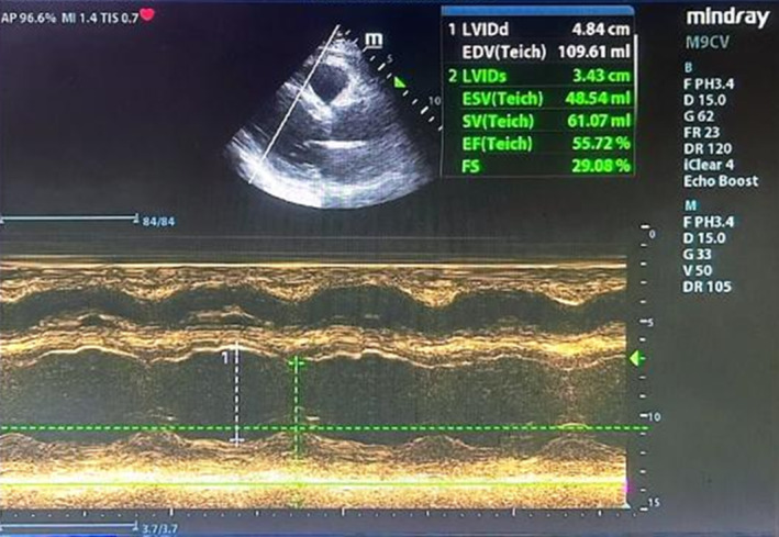 FIGURE 3