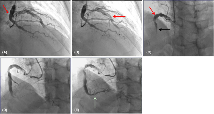 FIGURE 2