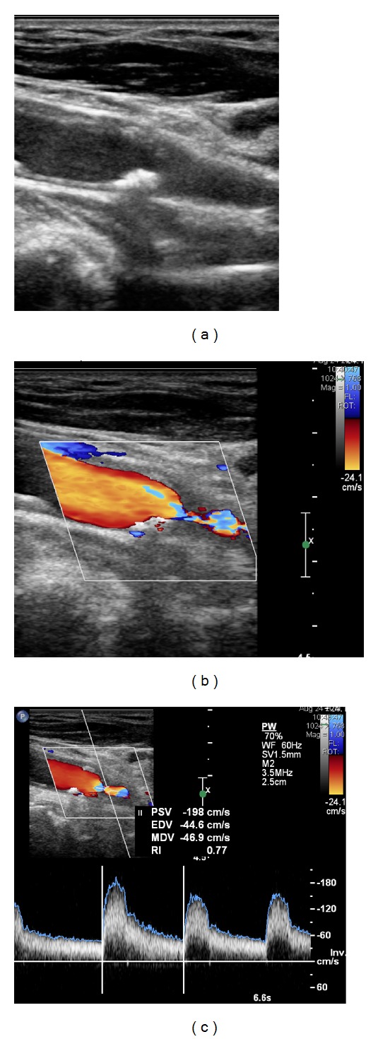 Figure 4