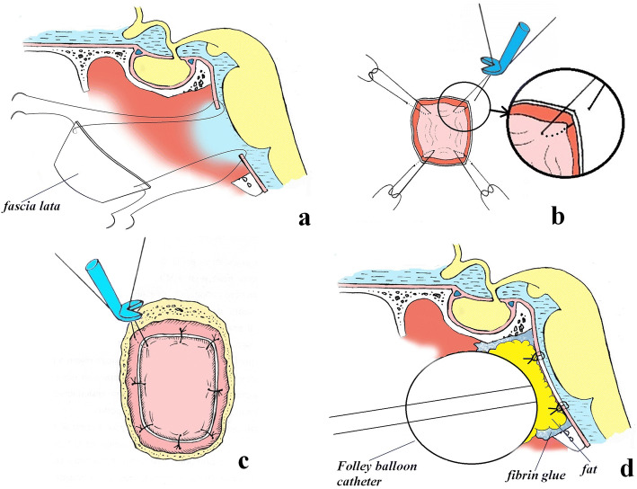 Fig. 7