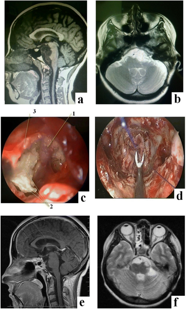 Fig. 5