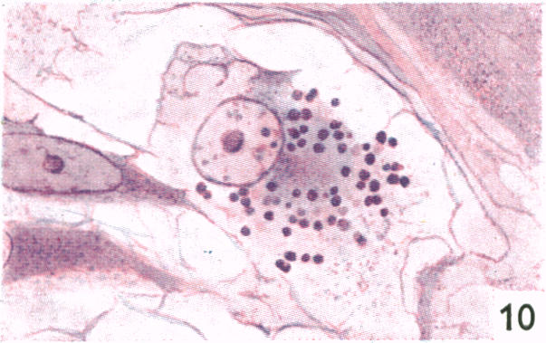 Fig. 10