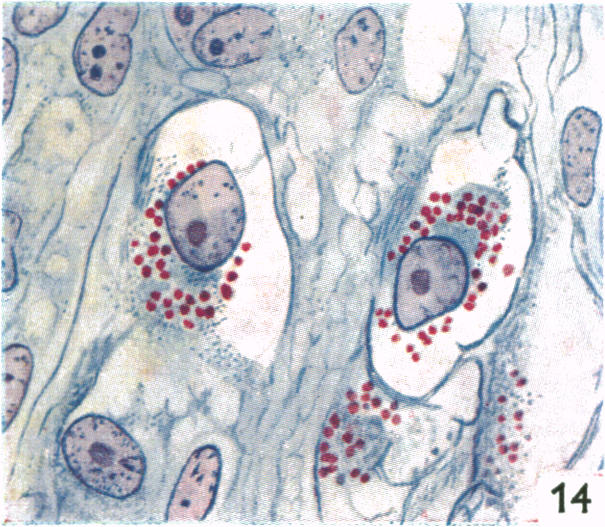 Fig. 14