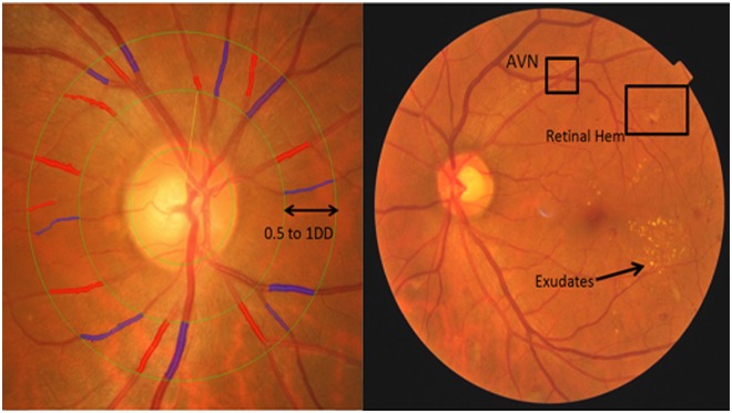 Fig 1