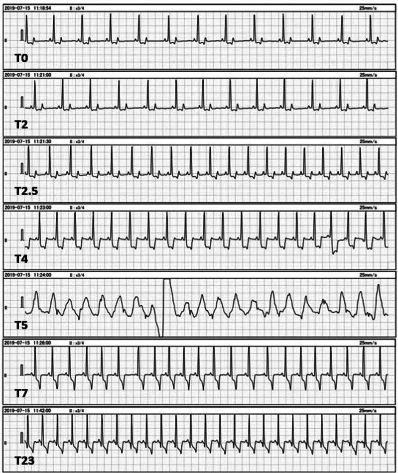 Fig. 2.