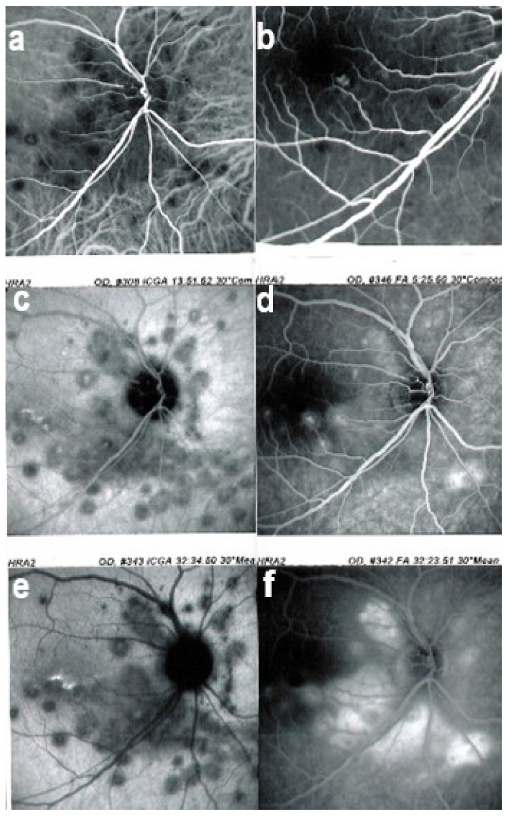 Figure 16