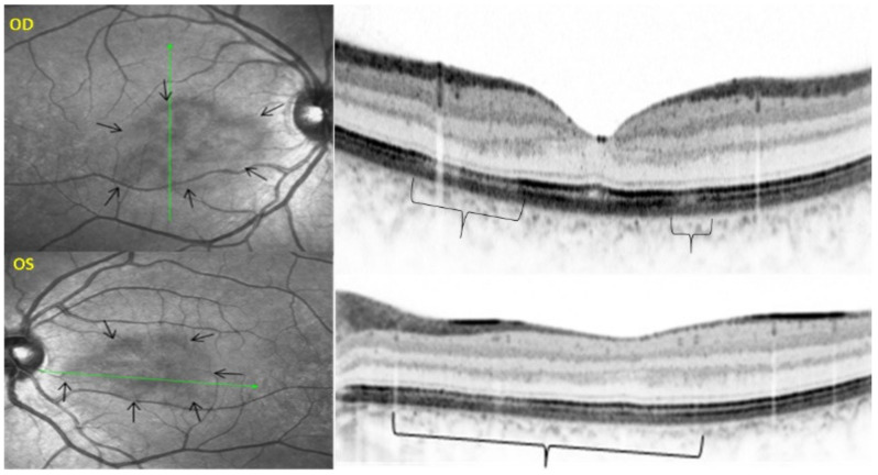 Figure 32