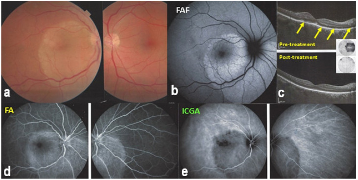 Figure 28