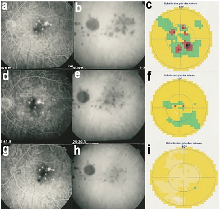 Figure 17