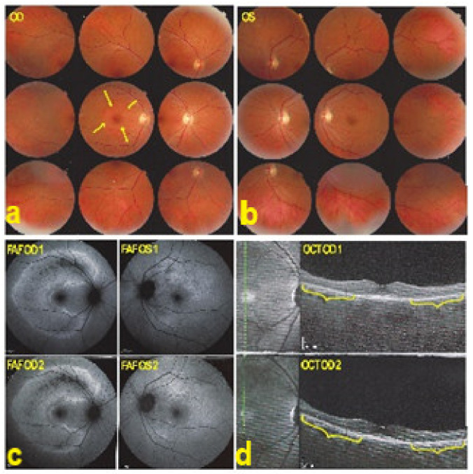 Figure 36