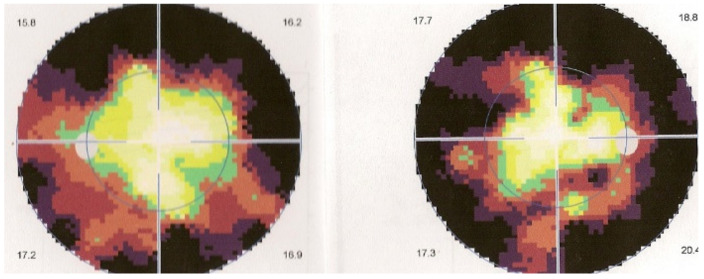 Figure 44