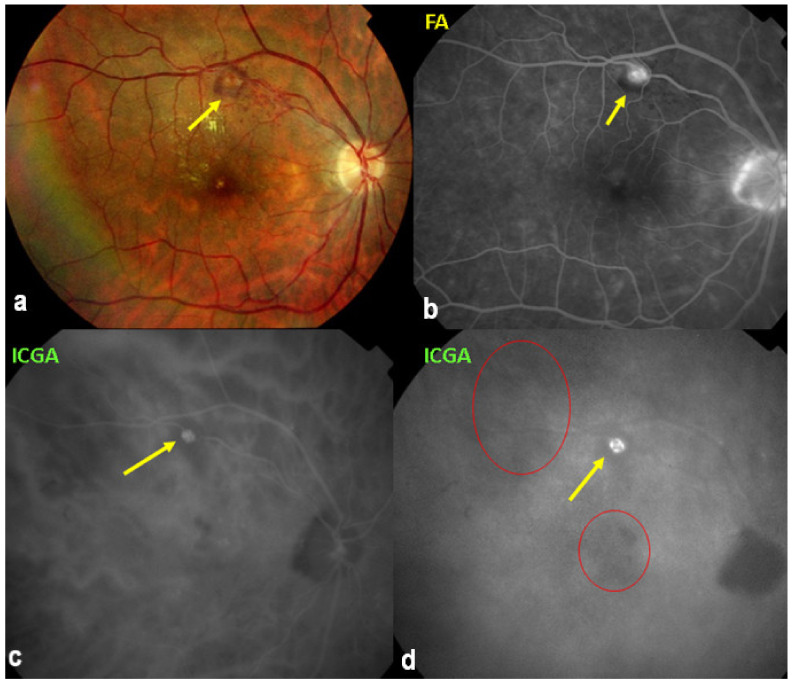 Figure 53