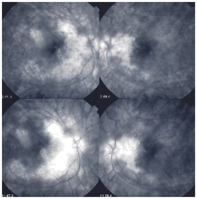 Figure 43