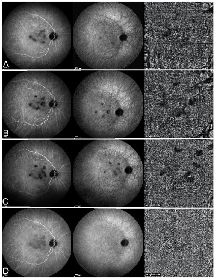 Figure 25