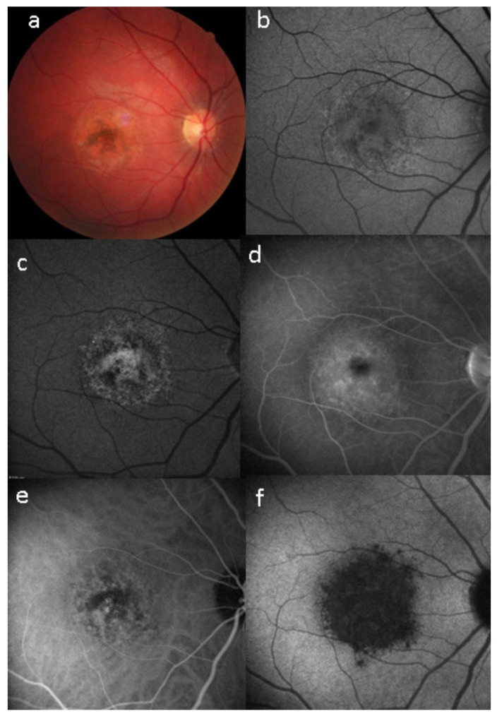 Figure 33