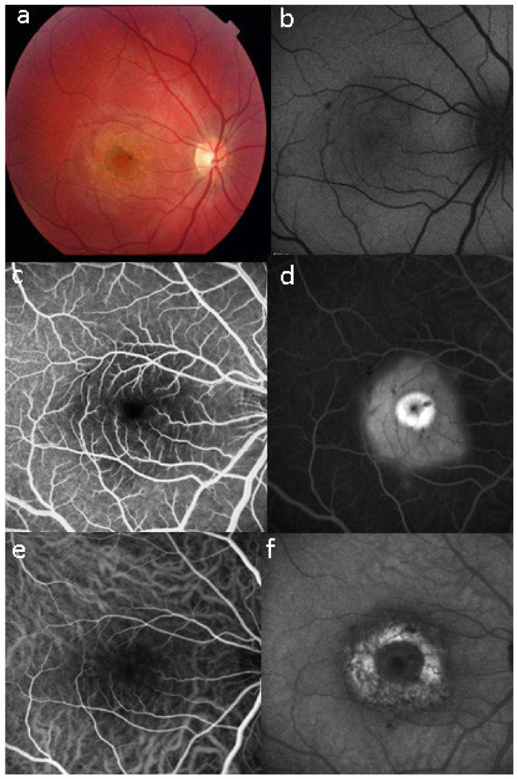 Figure 35