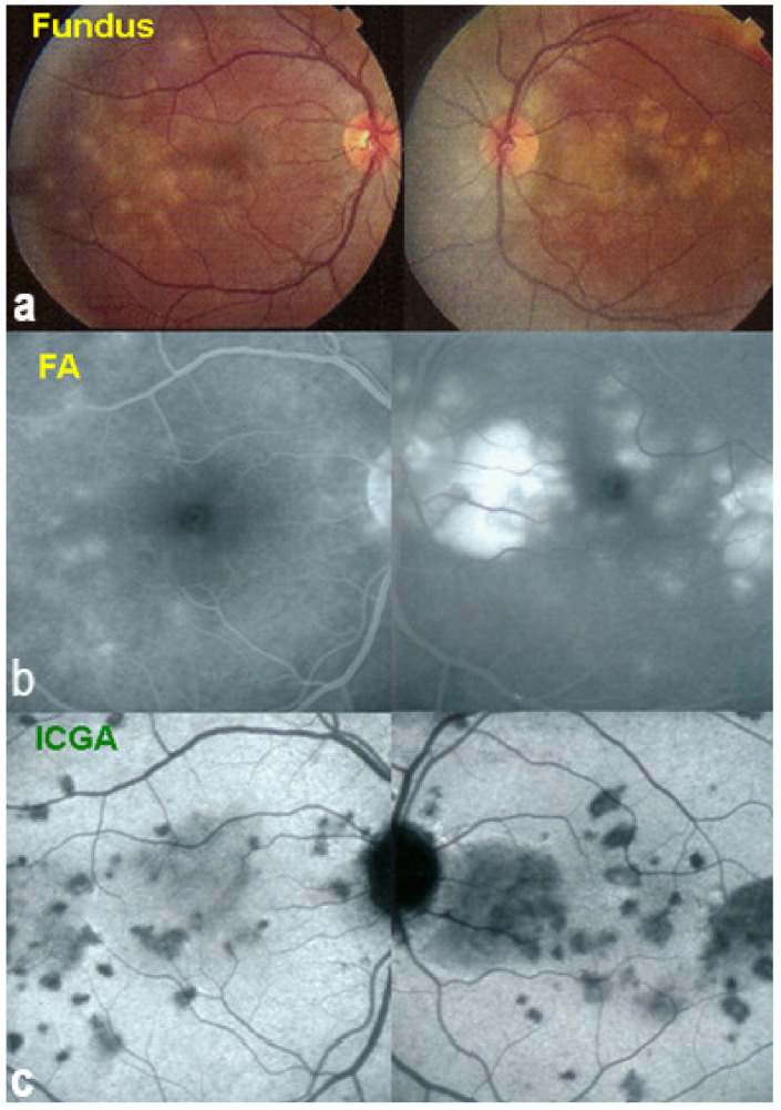 Figure 11