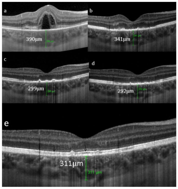 Figure 34