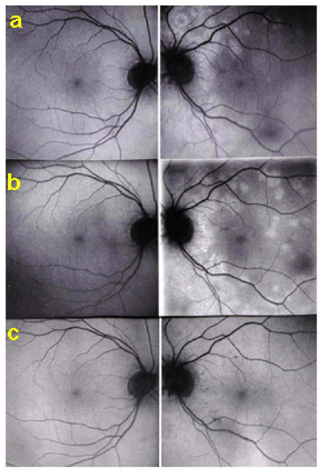 Figure 21