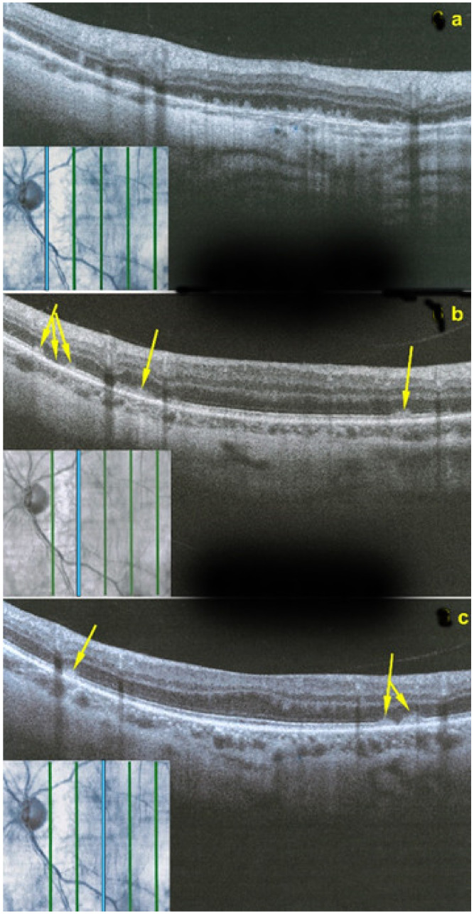 Figure 22