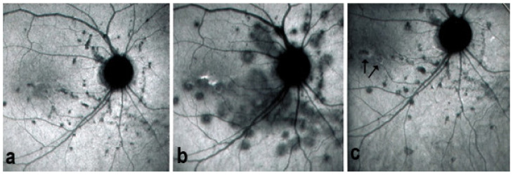 Figure 14