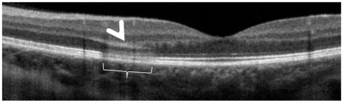 Figure 30