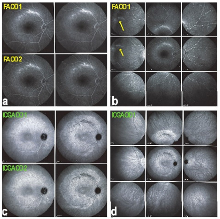 Figure 37