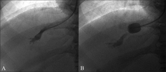 Figure 1 (A, B)