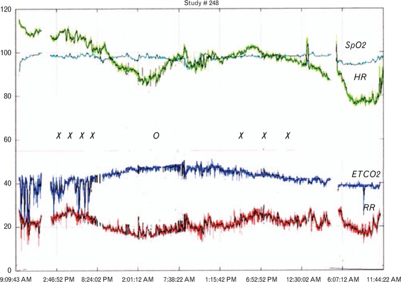 Fig. 3