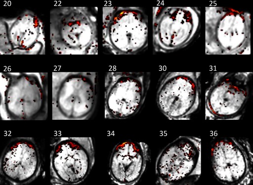 fMRI images showing bilateral activity patterns in fetal frontal regions at gestational weeks 20 through 36.