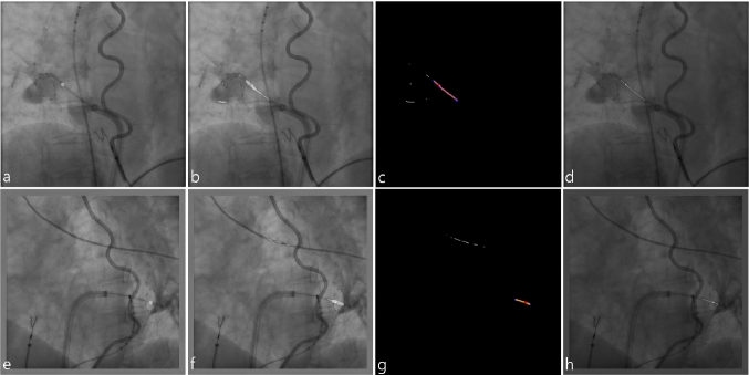 Fig. 6