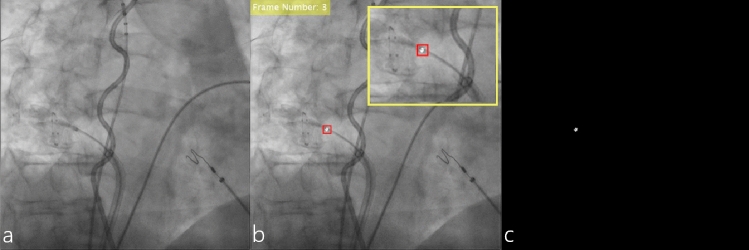 Fig. 2