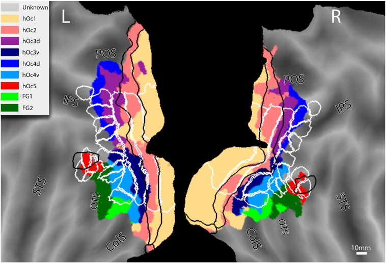 Fig. 12