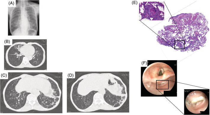 FIGURE 1