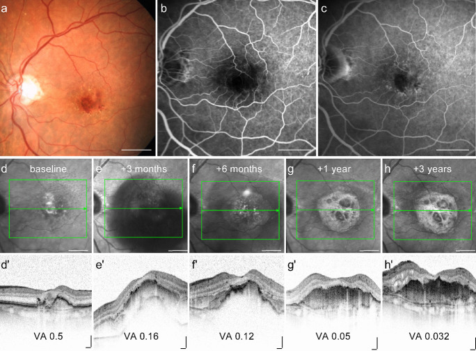 Fig. 2