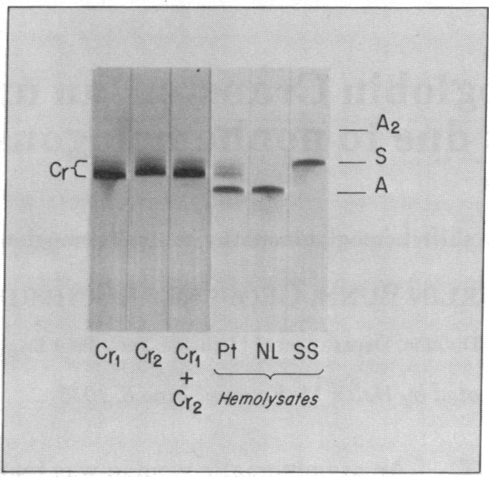 graphic file with name pnas00052-0352-a.jpg