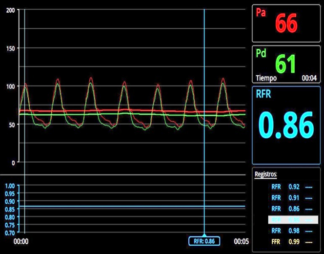 Figure 3