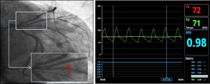 Figure 4